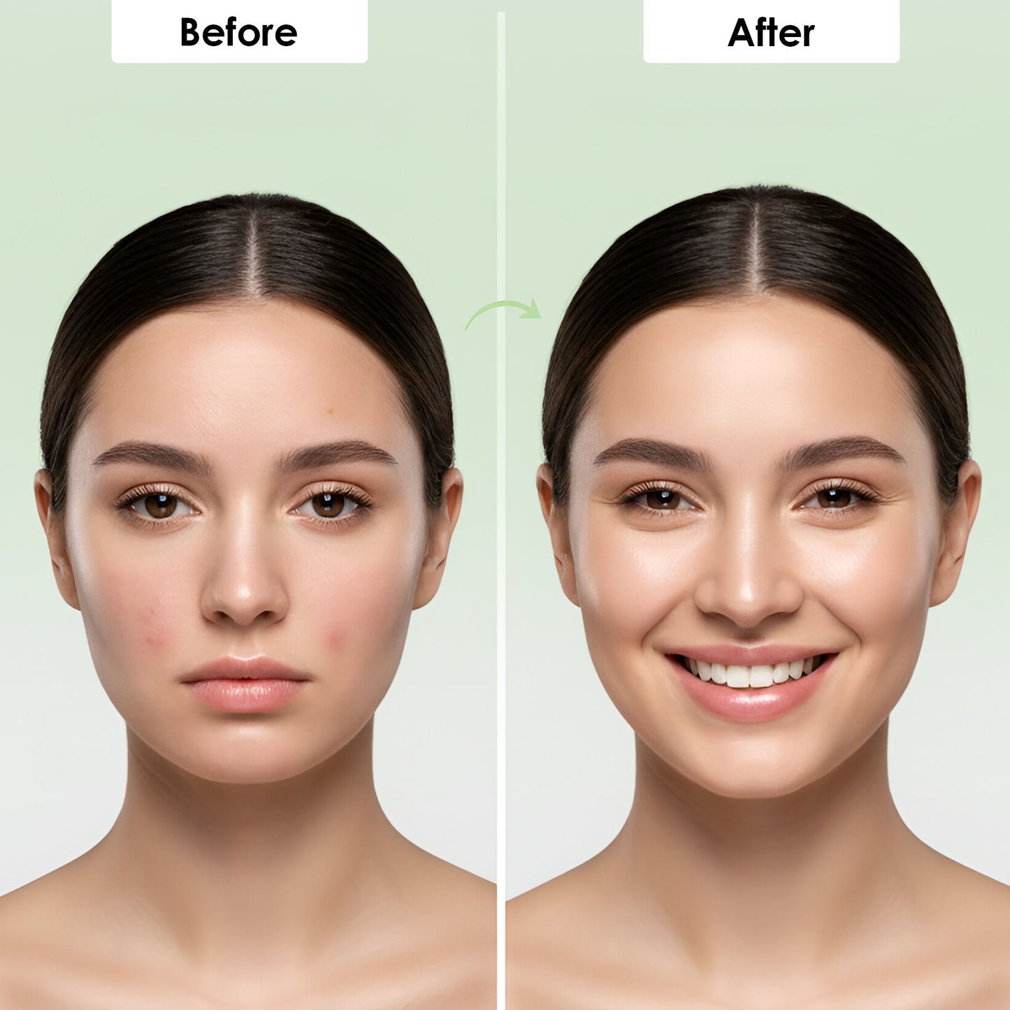 2% Salicylic Acid Anti-Acne Serum