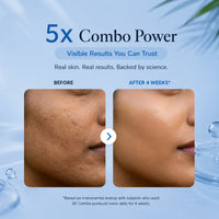 KOXA 5X Ceramide Cleanser & Soothing Toner Combo