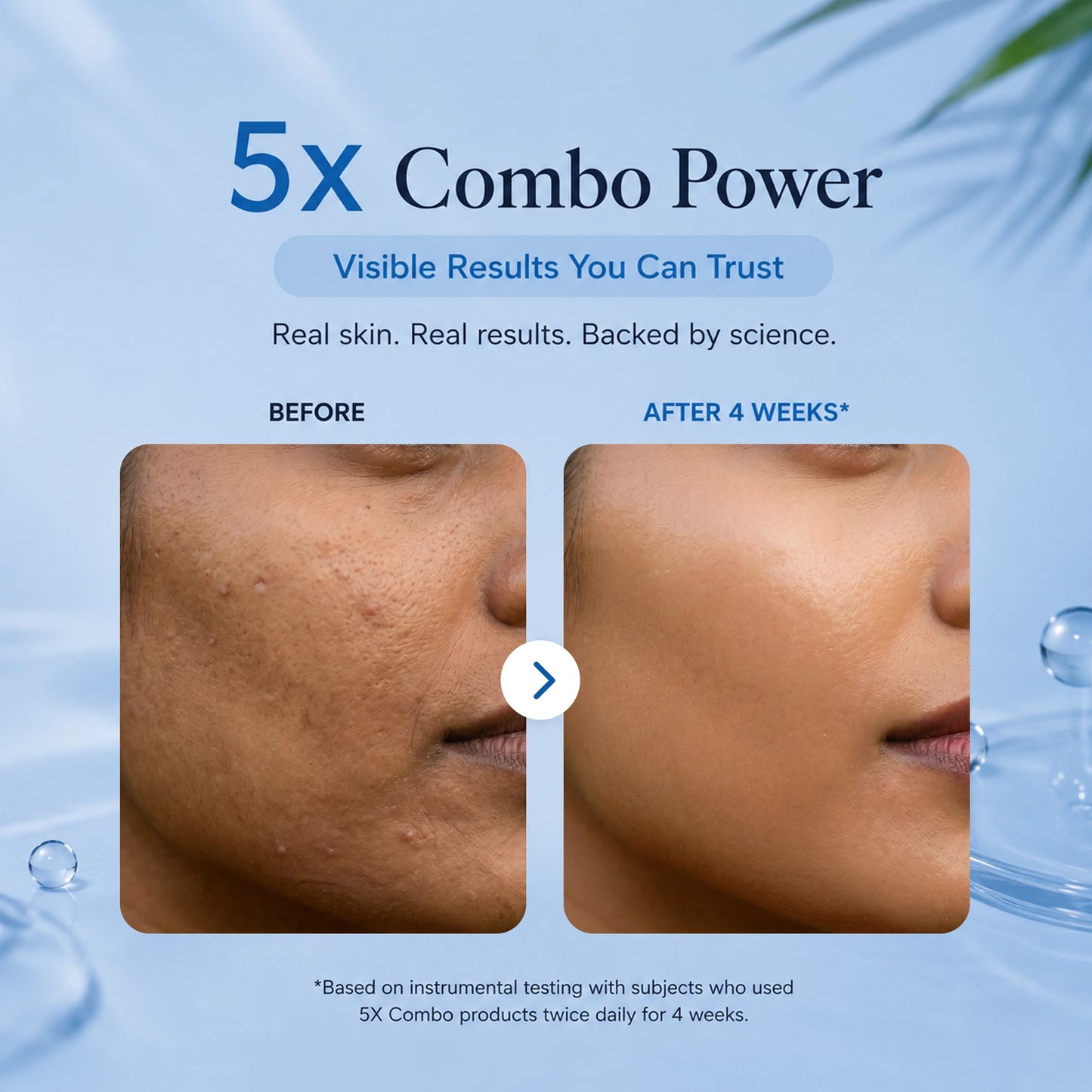 KOXA 5X Ceramide Cleanser & Barrier Serum Combo